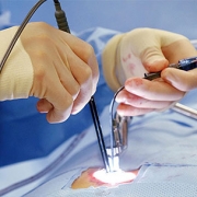 آیا عمل دیسک کمر خطرناک است