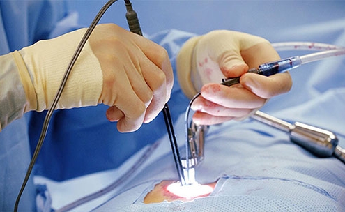 آیا عمل دیسک کمر خطرناک است