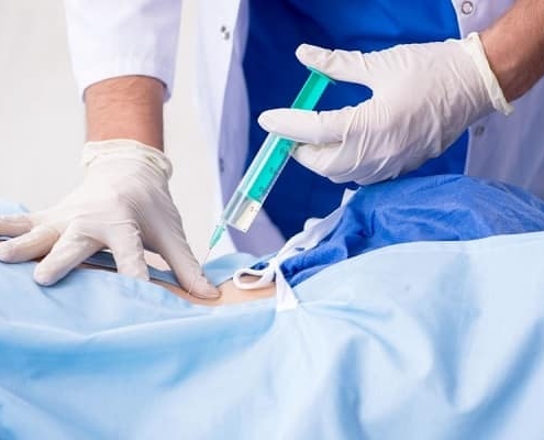 تزریق ژل به ستون فقرات