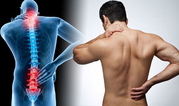 علائم دیسک کمر 