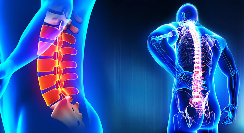 علائم دیسکوپاتی کمر