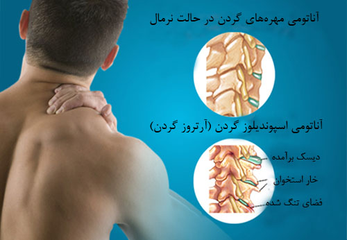آناتومی گردن 
