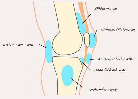 عکس انواع بورسیت زانو