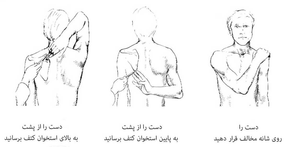 ورزش برای شانه یخ زده