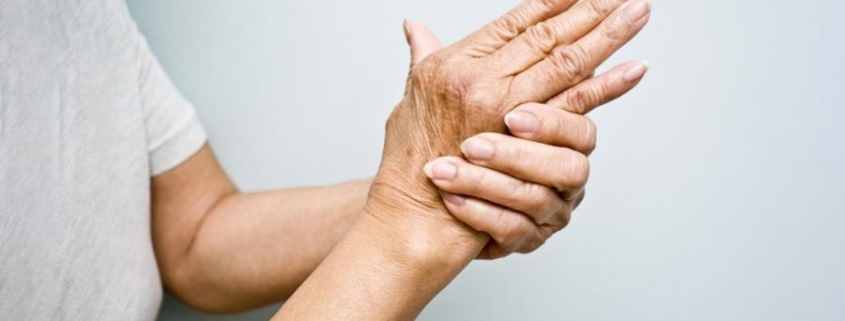 آرتریت روماتوئید