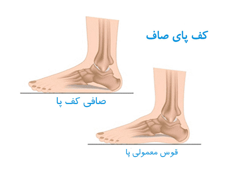کف پای صاف