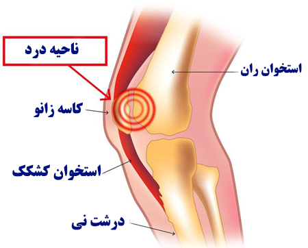 نرمی زانو 