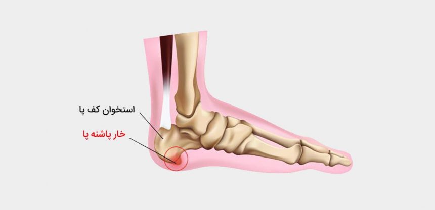 درد در پاشنه پا