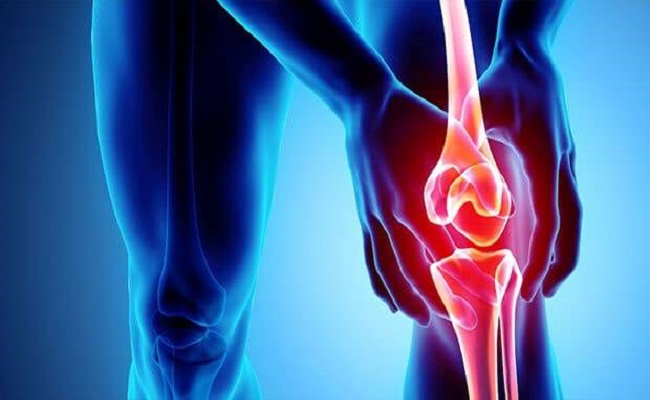 آرتریت مفصلی