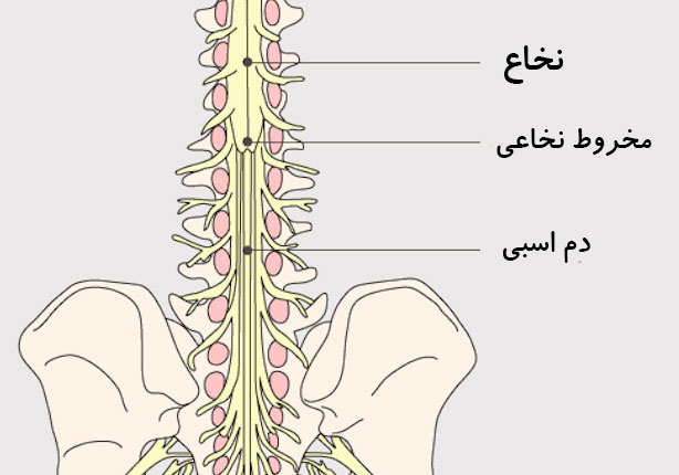 عکس ضایعه نخاعی