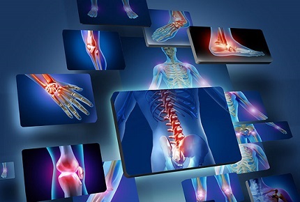 تاثیر ژنتیک در استخوان ها