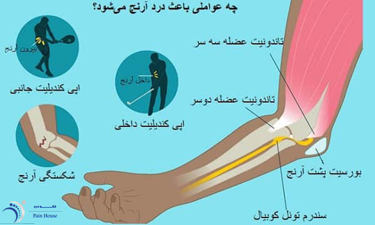 دلایل درد آرنج