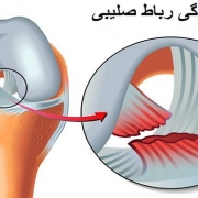 رباط صلیبی قدامی