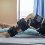 دوره نقاهت بعد از عمل رباط صلیبی