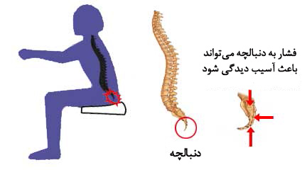استخوان دنبالچه