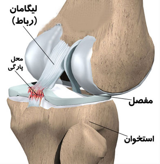 لیگامان زانو