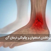 مو برداشتن استخوان
