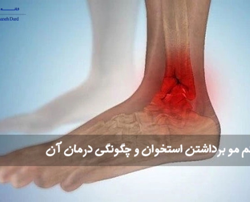 مو برداشتن استخوان