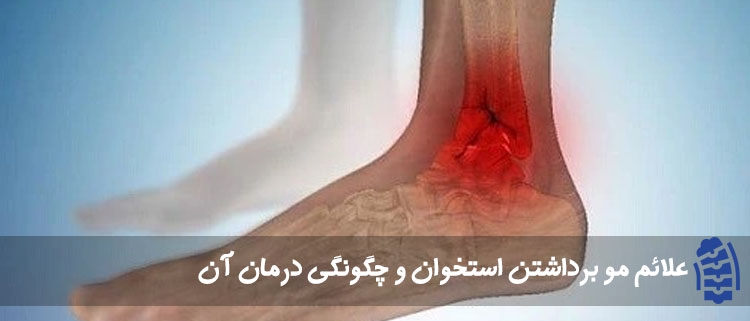 مو برداشتن استخوان