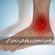 مو برداشتن استخوان