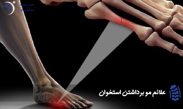 علائم مو برداشتن پا