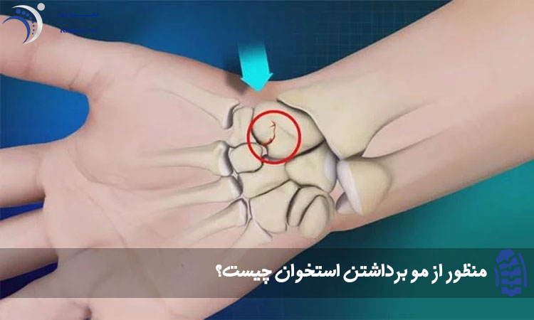 عکس مو برداشتن