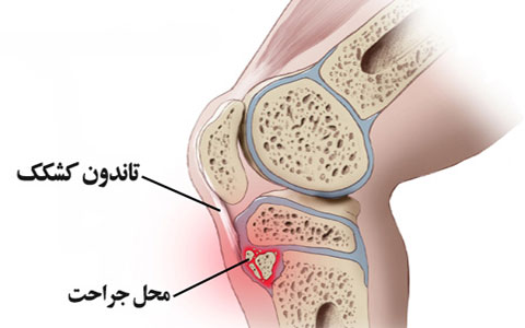 عکس ازگود اشلاتر 