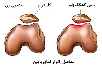 عکس کاسه ی زانو