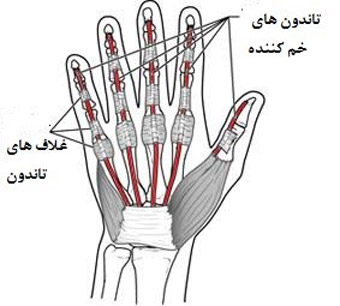 تاندون فلکسور