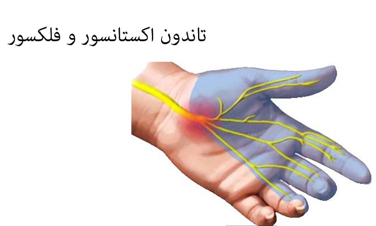 آسیب های تاندون فلکسور