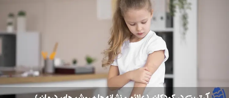 آرتریت در کودکان ( علائم و نشانه ها + روش های درمان)