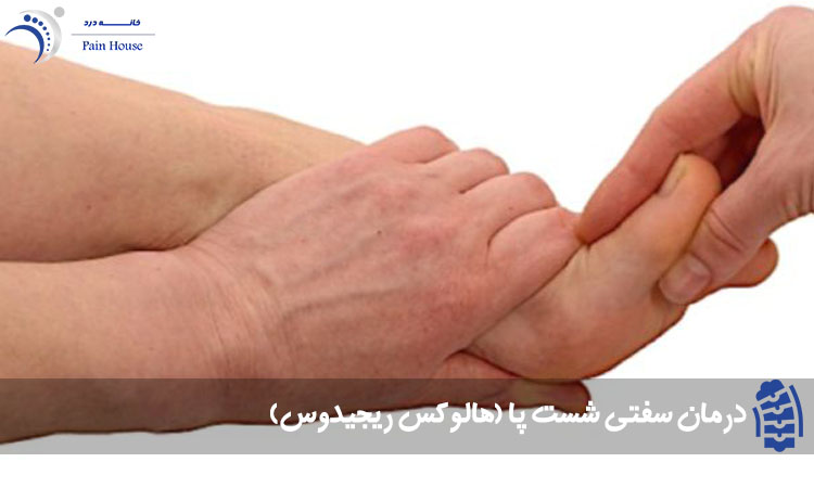 درمان سفتی شست پا(هالوکس ریجیدوس)
