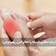 سفتی شست پا