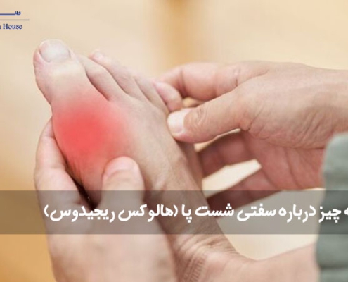سفتی شست پا