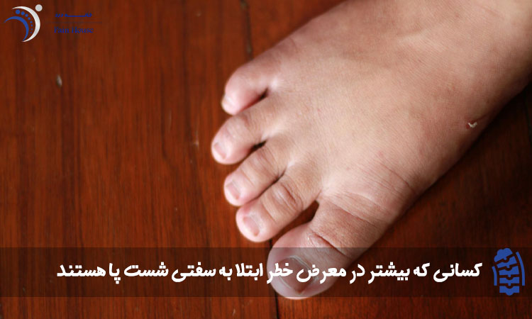 بیماری سفتی شست پا