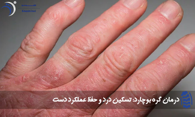 درمان گره‌ بوچارد