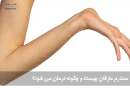 سندرم مارفان چیست و چگونه درمان می شود؟