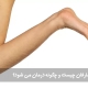 سندرم مارفان چیست و چگونه درمان می شود؟