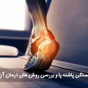 علائم شکستگی پاشنه پا و بررسی روش های درمان آن