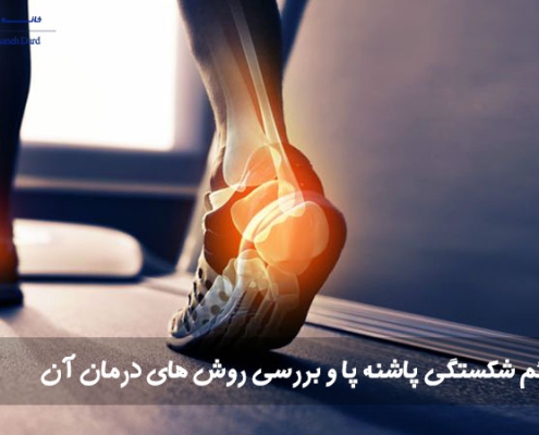 علائم شکستگی پاشنه پا و بررسی روش های درمان آن