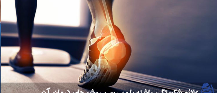 علائم شکستگی پاشنه پا و بررسی روش های درمان آن