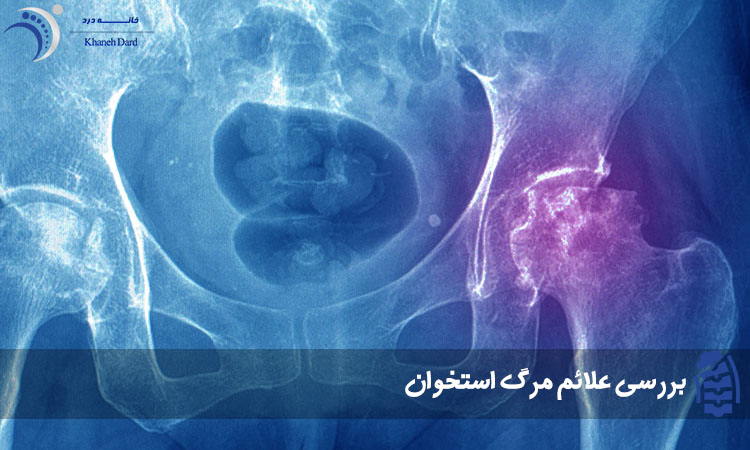 علائم مرگ استخوان چیست؟