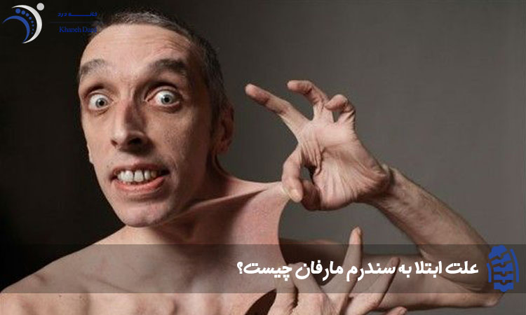 علت ابتلا به سندرم مارفان