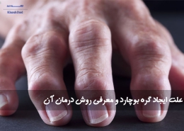 علت ایجاد گره بوچارد و معرفی روش درمان آن