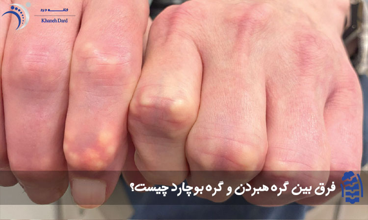 فرق بین گره‌ هبردن و گره‌ بوچارد