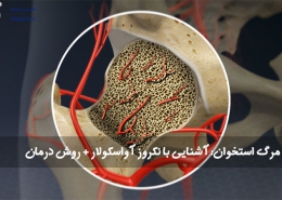 مرگ استخوان آشنایی با نکروز آواسکولار روش درمان